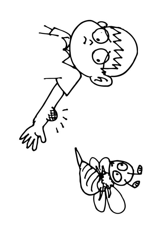 piqûre d'abeille