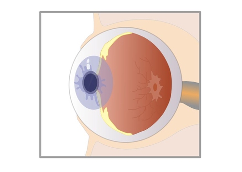 section de l'oeil