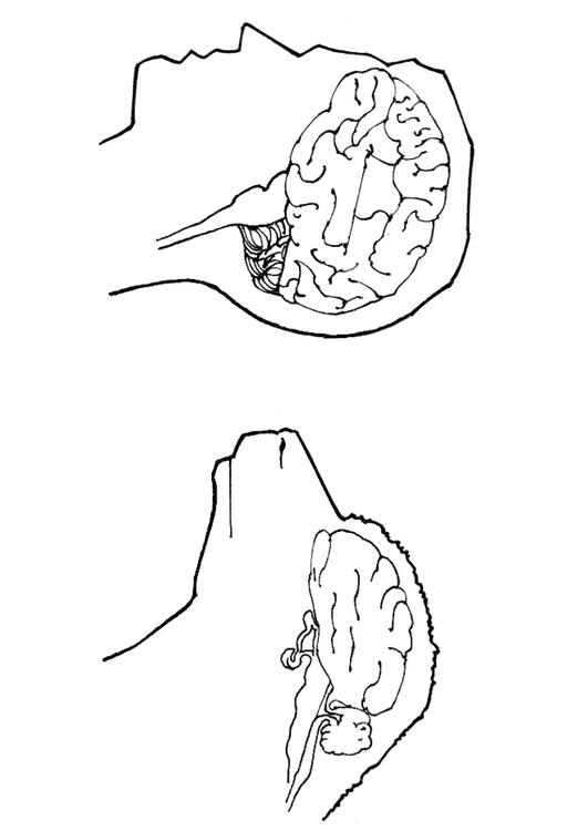 cervelle homme et mouton