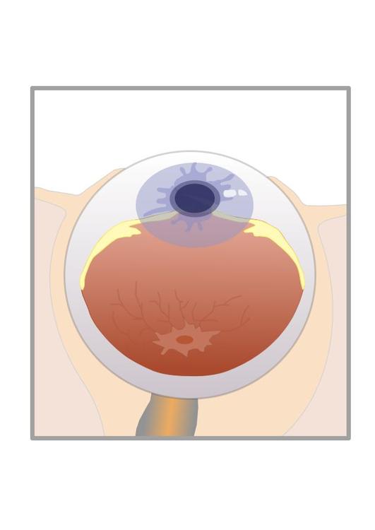 section de l'oeil