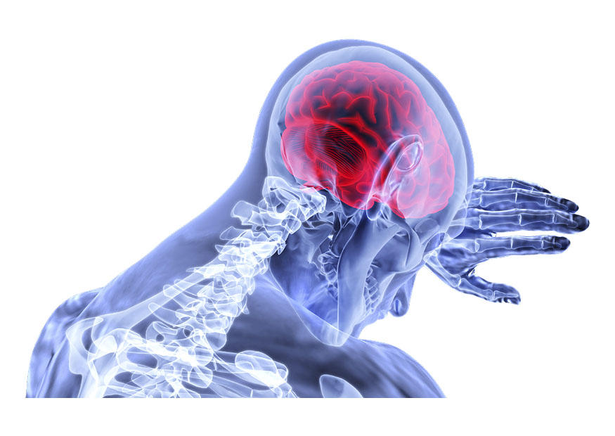 cerveau Image cerveau